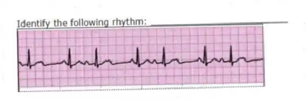 Identify the following rhythm: _________________________