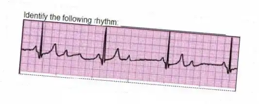 Identify the following rhythm: _________________________