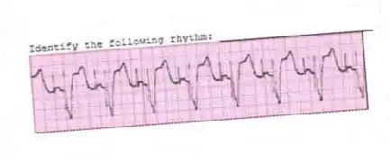Identify the following rhythm: _________________________