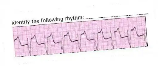 Identify the following rhythm: _________________________
 