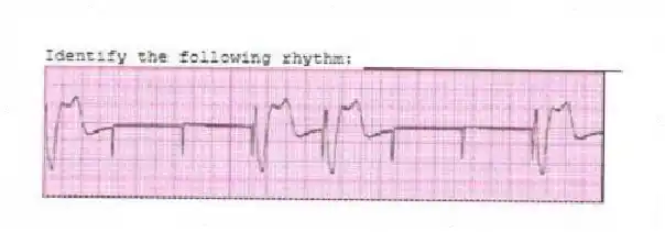 Identify the following rhythm: _________________________