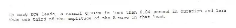 In most ECG leads, a normal Q wave is less than 0.04 second in duration and less than one third of the amplitude of the R wave in that lead.