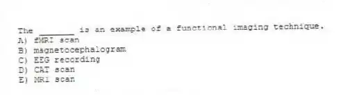 The _______ is an example of a functional imaging technique.
A) fMRI scan
B) magnetocephalogram
C) EEG recording
D) CAT scan
E) MRI scan