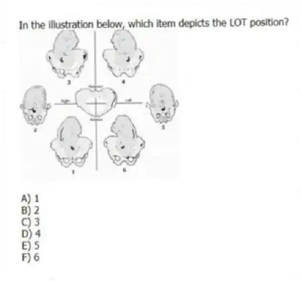 In the illustration below, which item depicts the LOT position?
A) 1
B) 2
C) 3
D) 4
E) 5
F) 6