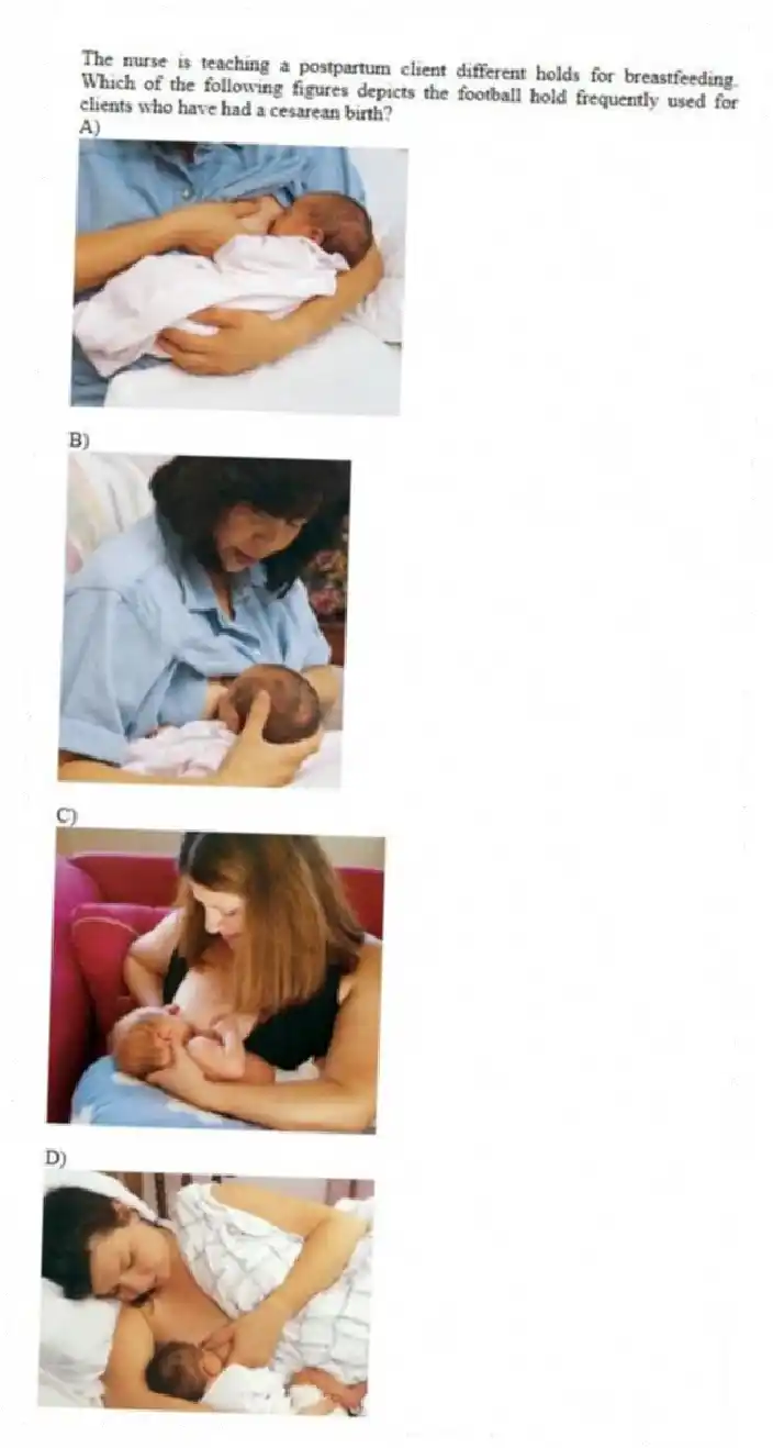 The nurse is teaching a postpartum client different holds for breastfeeding. Which of the following figures depicts the football hold frequently used for clients who have had a cesarean birth?